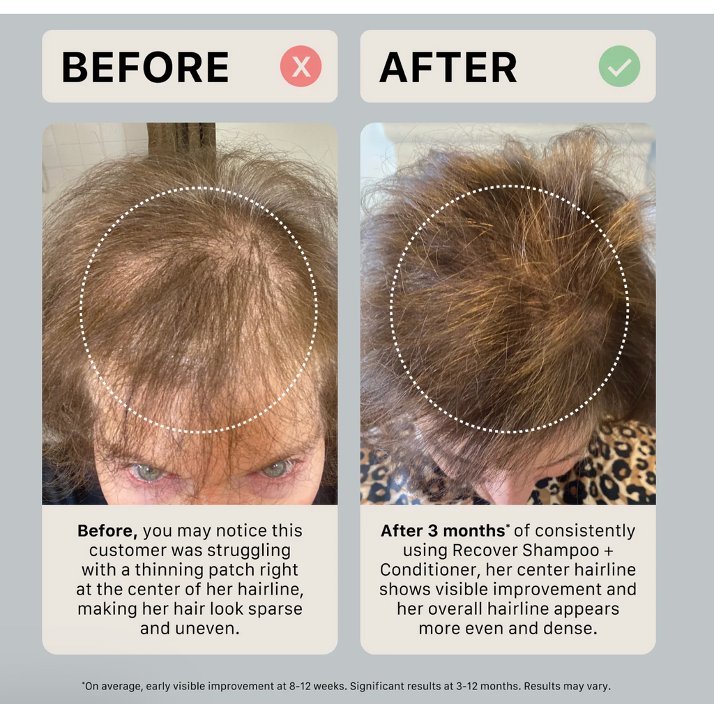 Après-shampoing épaississant Activiv Recover