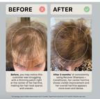 Après-shampoing épaississant Activiv Recover