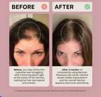 Shampoing épaississant Actiiv Recover pour femmes