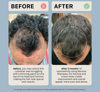 Shampoing épaississant Actiiv Recover pour hommes