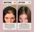 Actiiv Recover Duo format voyage pour femmes