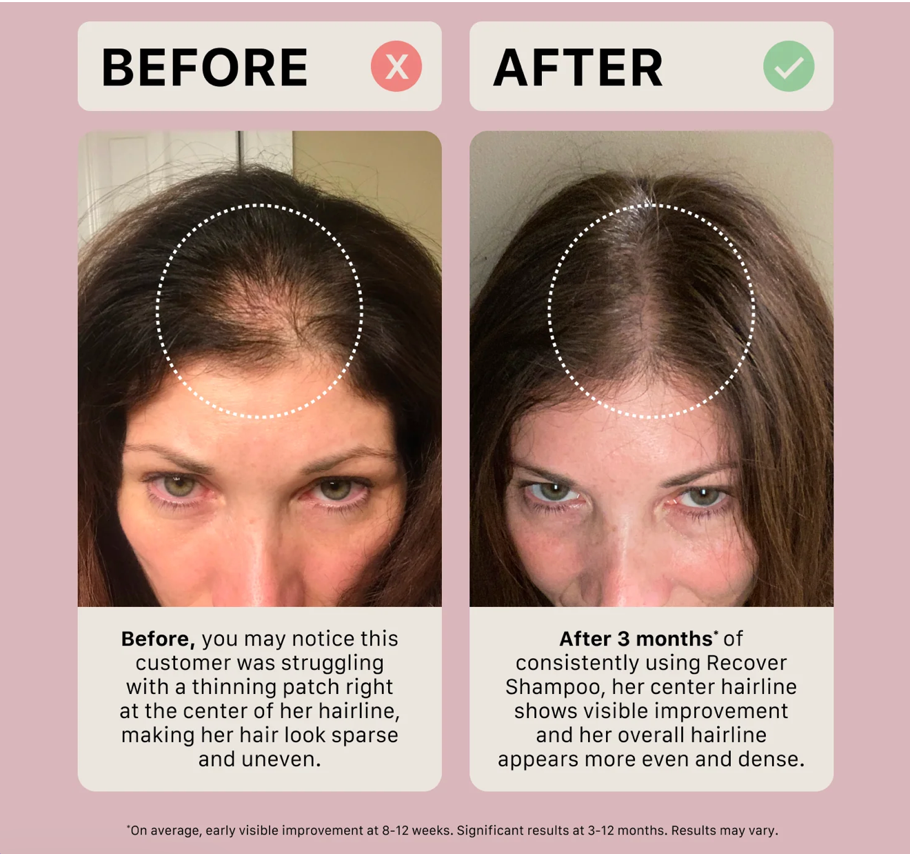 Actiiv Recover Duo format voyage pour femmes