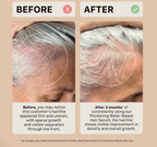 Sérum capillaire épaississant Actiiv – À base d'eau