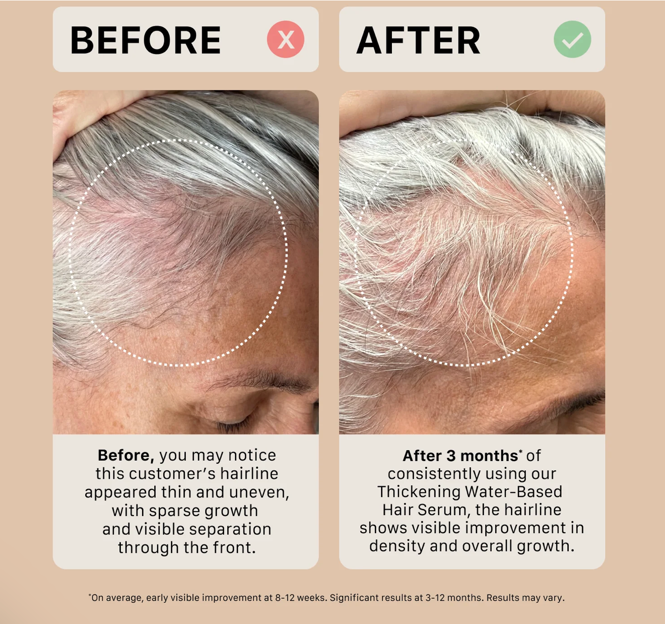 Sérum capillaire épaississant Actiiv – À base d'eau