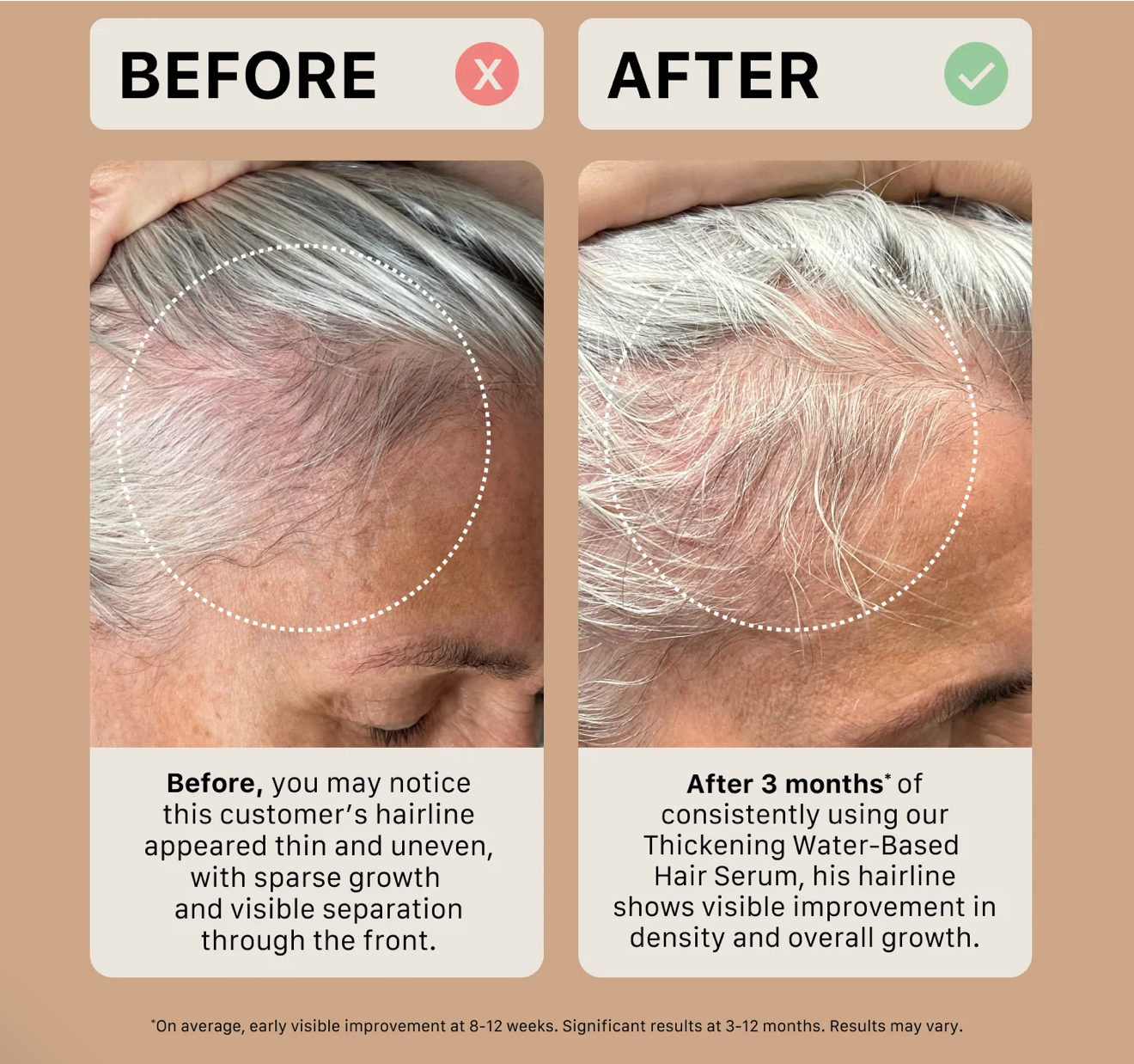 Sérum capillaire épaississant Actiiv – À base d'huile pour cheveux texturés