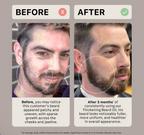 Huile à barbe épaississante Activiv – Parfum classique